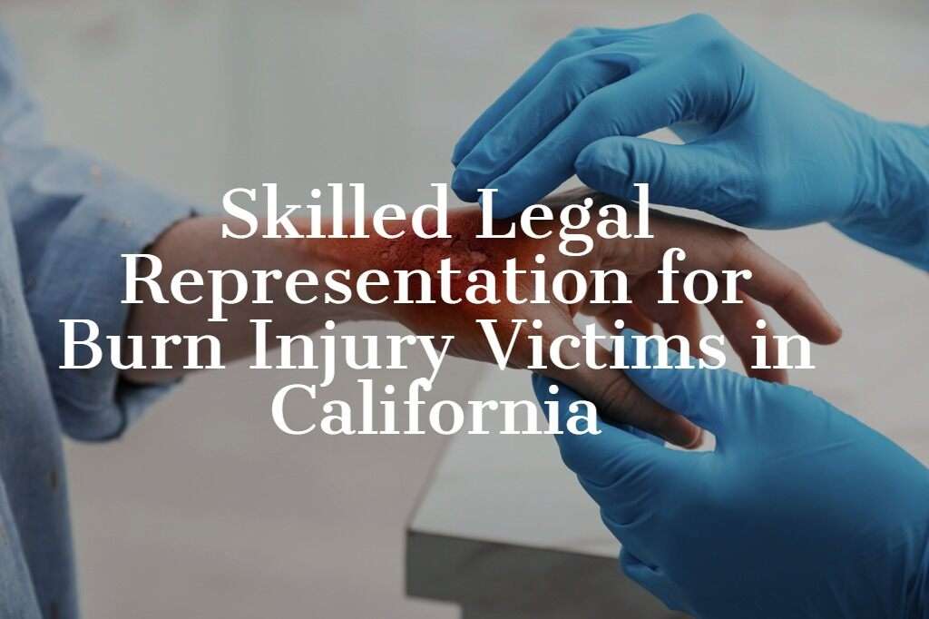 burn injury lawyer ca doctor checking patient burning hand