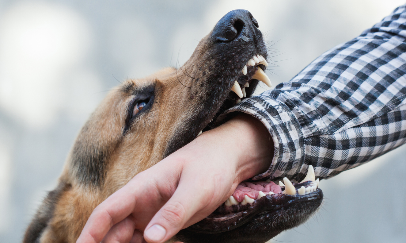 Perro pastor alemán mordiendo el brazo de una persona, mostrando los dientes del perro y la manga de la persona durante el incidente.